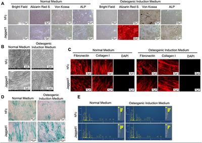 Effects of decellularized extracellular matrix derived from Jagged1-treated human dental pulp stem cells on biological responses of stem cells isolated from apical papilla